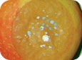 Lesions on the calyx end, purplish, at first, eventually the entire calyx end becomes blistered and deformed; tube-like structures and powdery, bright orange spores may be present. 