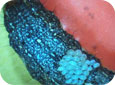 Icheneumonid eggs on a caterpillar